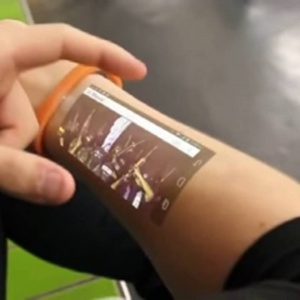 tech arm digital intervention